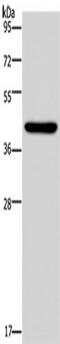 NPHS2 Stomatin Family Member, Podocin antibody, TA351459, Origene, Western Blot image 