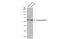 Synaptotagmin 2 antibody, GTX117819, GeneTex, Western Blot image 