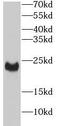 Angiopoietin Like 8 antibody, FNab09883, FineTest, Western Blot image 