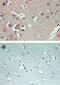 Adenosine Monophosphate Deaminase 1 antibody, PA5-23173, Invitrogen Antibodies, Immunohistochemistry paraffin image 