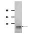 Aldolase, Fructose-Bisphosphate A antibody, GTX40552, GeneTex, Western Blot image 