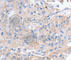 Potassium Voltage-Gated Channel Subfamily A Member 1 antibody, A2992, ABclonal Technology, Immunohistochemistry paraffin image 
