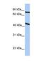 Potassium Two Pore Domain Channel Subfamily K Member 4 antibody, NBP1-69621, Novus Biologicals, Western Blot image 