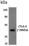 Cytotoxic T-Lymphocyte Associated Protein 4 antibody, GTX52659, GeneTex, Western Blot image 