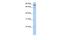 Mitofusin 2 antibody, PA5-42172, Invitrogen Antibodies, Western Blot image 