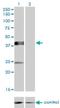 Sphingomyelin Synthase 2 antibody, H00166929-M08, Novus Biologicals, Western Blot image 