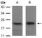 ADP Ribosylation Factor 5 antibody, PA5-21608, Invitrogen Antibodies, Western Blot image 