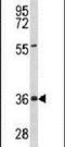 Peroxisomal Biogenesis Factor 16 antibody, PA5-26158, Invitrogen Antibodies, Western Blot image 