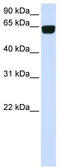 Phosphatidylinositol Glycan Anchor Biosynthesis Class T antibody, TA341989, Origene, Western Blot image 