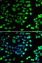 N-Terminal Xaa-Pro-Lys N-Methyltransferase 1 antibody, STJ29178, St John