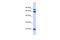Protein Phosphatase 2 Scaffold Subunit Aalpha antibody, 27-097, ProSci, Western Blot image 