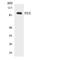 FES Proto-Oncogene, Tyrosine Kinase antibody, LS-C291947, Lifespan Biosciences, Western Blot image 