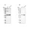 Mitochondrial Trans-2-Enoyl-CoA Reductase antibody, PA5-54553, Invitrogen Antibodies, Western Blot image 