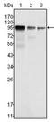 FER Tyrosine Kinase antibody, AM06187SU-N, Origene, Western Blot image 