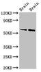 WASP Family Member 1 antibody, LS-C680014, Lifespan Biosciences, Western Blot image 