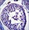 Tripartite Motif Containing 39 antibody, LS-C160193, Lifespan Biosciences, Immunohistochemistry paraffin image 