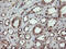 Chaperonin Containing TCP1 Subunit 8 Like 2 antibody, M16124-2, Boster Biological Technology, Immunohistochemistry paraffin image 