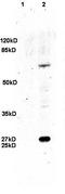 CD160 Molecule antibody, orb13302, Biorbyt, Western Blot image 