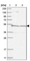 Solute Carrier Organic Anion Transporter Family Member 4A1 antibody, NBP1-80977, Novus Biologicals, Western Blot image 