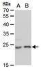 Lin-7 Homolog A, Crumbs Cell Polarity Complex Component antibody, MA5-18305, Invitrogen Antibodies, Western Blot image 