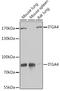 CD49D antibody, GTX64399, GeneTex, Western Blot image 