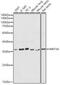 Wnt Family Member 3A antibody, GTX64367, GeneTex, Western Blot image 