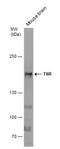 Tenascin R antibody, NBP2-20677, Novus Biologicals, Western Blot image 