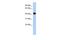 RasGEF Domain Family Member 1C antibody, GTX45211, GeneTex, Western Blot image 