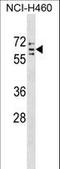 Cytochrome P450 Family 4 Subfamily V Member 2 antibody, LS-C159432, Lifespan Biosciences, Western Blot image 
