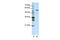 Cleavage And Polyadenylation Specific Factor 7 antibody, GTX47252, GeneTex, Western Blot image 