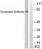 Tyrosinase antibody, LS-C118628, Lifespan Biosciences, Western Blot image 