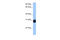 Insulin Like Growth Factor Binding Protein 7 antibody, 30-372, ProSci, Western Blot image 