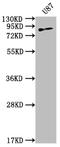 Transglutaminase 2 antibody, CSB-RA147681A0HU, Cusabio, Western Blot image 