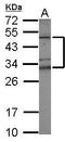 Zinc finger and BTB domain-containing protein 32 antibody, GTX115832, GeneTex, Western Blot image 