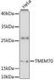 Transmembrane Protein 70 antibody, LS-C748749, Lifespan Biosciences, Western Blot image 