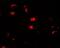 Ubiquitin Specific Peptidase 25 antibody, NBP2-82051, Novus Biologicals, Immunocytochemistry image 