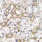 CD38 Molecule antibody, LS-C331640, Lifespan Biosciences, Immunohistochemistry paraffin image 