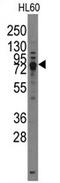 Transient Receptor Potential Cation Channel Subfamily V Member 3 antibody, AP11389PU-N, Origene, Western Blot image 