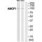 ATP Binding Cassette Subfamily F Member 1 antibody, PA5-49986, Invitrogen Antibodies, Western Blot image 