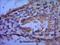 General Transcription Factor IIB antibody, M06893, Boster Biological Technology, Immunohistochemistry paraffin image 