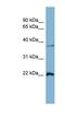 RAN, Member RAS Oncogene Family antibody, NBP1-58107, Novus Biologicals, Western Blot image 