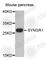 Synaptogyrin 1 antibody, A8175, ABclonal Technology, Western Blot image 