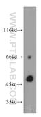 Transcobalamin 2 antibody, 12157-1-AP, Proteintech Group, Western Blot image 