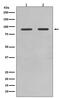 Forkhead Box O1 antibody, M00073, Boster Biological Technology, Western Blot image 