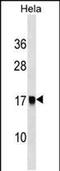 AP2S1 antibody, PA5-48858, Invitrogen Antibodies, Western Blot image 