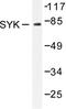 Spleen Associated Tyrosine Kinase antibody, LS-C176304, Lifespan Biosciences, Western Blot image 