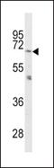 Proprotein Convertase Subtilisin/Kexin Type 2 antibody, PA5-14595, Invitrogen Antibodies, Western Blot image 