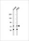 Autophagy Related 16 Like 2 antibody, 55-992, ProSci, Western Blot image 