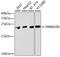 Translocase Of Inner Mitochondrial Membrane 10B antibody, 23-618, ProSci, Western Blot image 