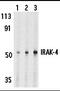 Interleukin 1 Receptor Associated Kinase 4 antibody, GTX25985, GeneTex, Western Blot image 
